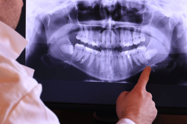 Best Holiday Emergency Dentist in Ossian, IN